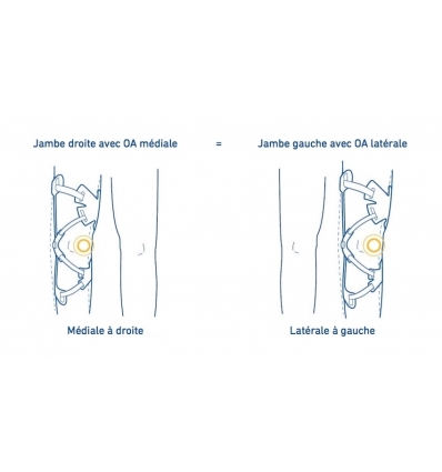 Version de l'orthèse de gonarthrose GenuTrain OA