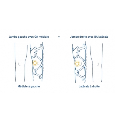Version de l'orthèse de gonarthrose GenuTrain OA