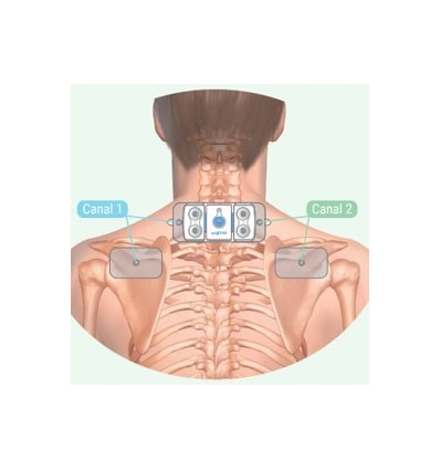 Electrode multisite ActiTens pour les omoplates