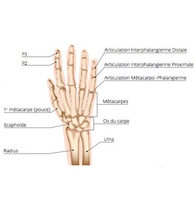 Attelle doigts (hors pouce) DigiForm Donjoy