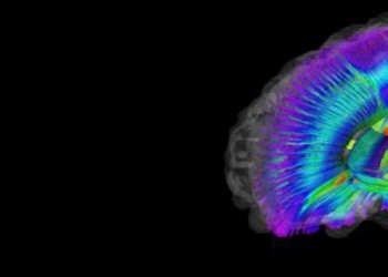 La stimulation magnétique pour faire face aux troubles de la motricité